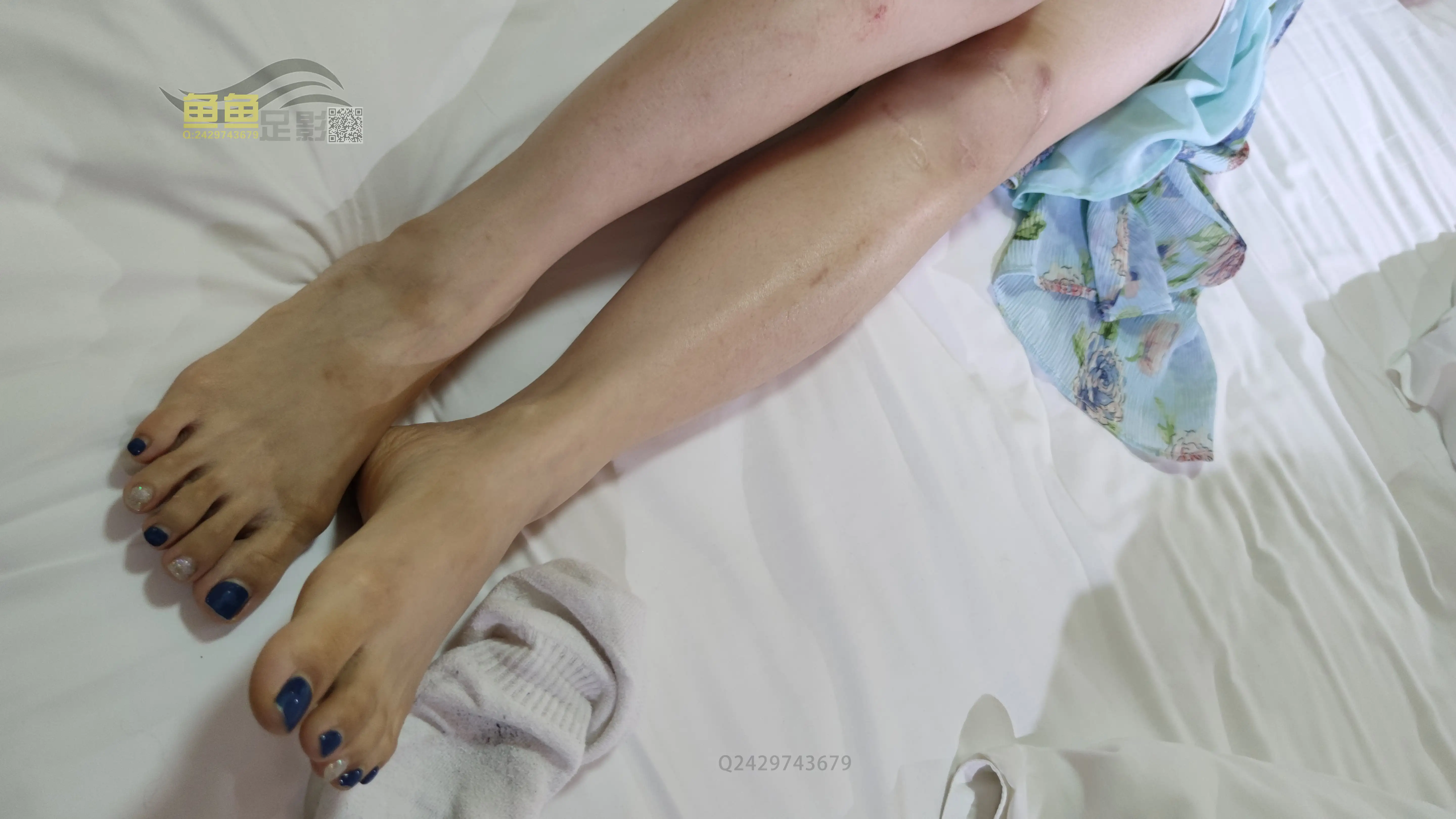 鱼鱼足影 NO.046 粥粥[181P+1V／972MB] - 第4张